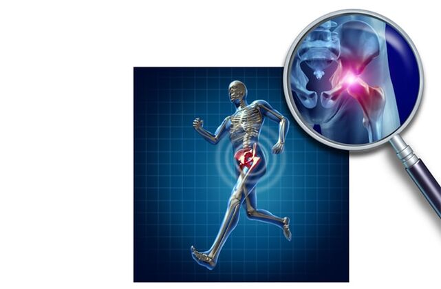 Dor ao correr na articulação do quadril